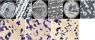 Screening and oenological property analysis of ethanol-tolerant non-Saccharomyces yeasts isolated from Rosa roxburghii Tratt